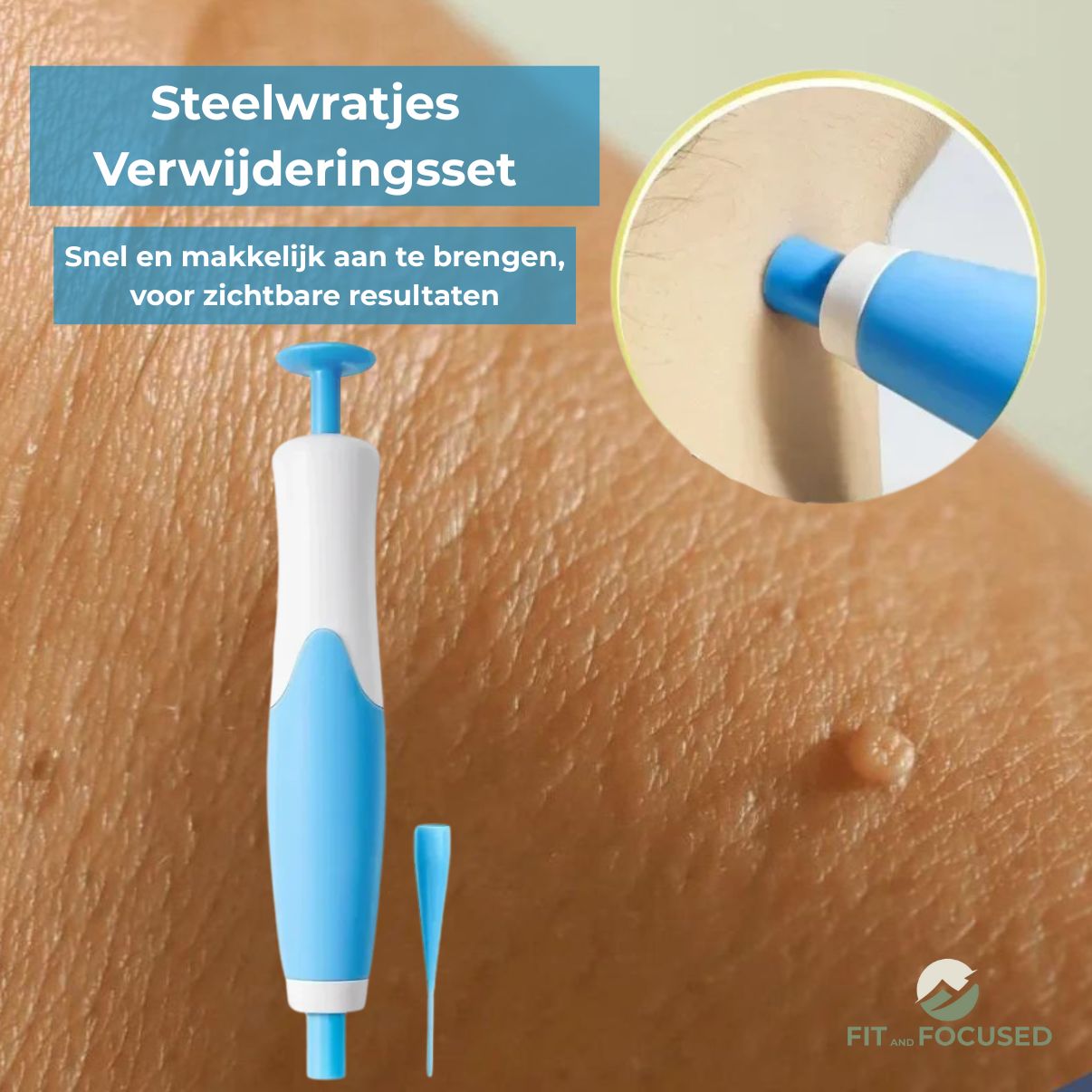 ClearSkin™ Skin Tag Remover
