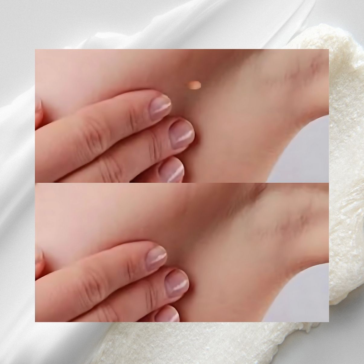 ClearSkin™ Skin Tag Remover